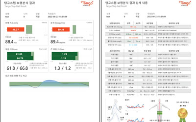 보행분석검사지 출력물 제공